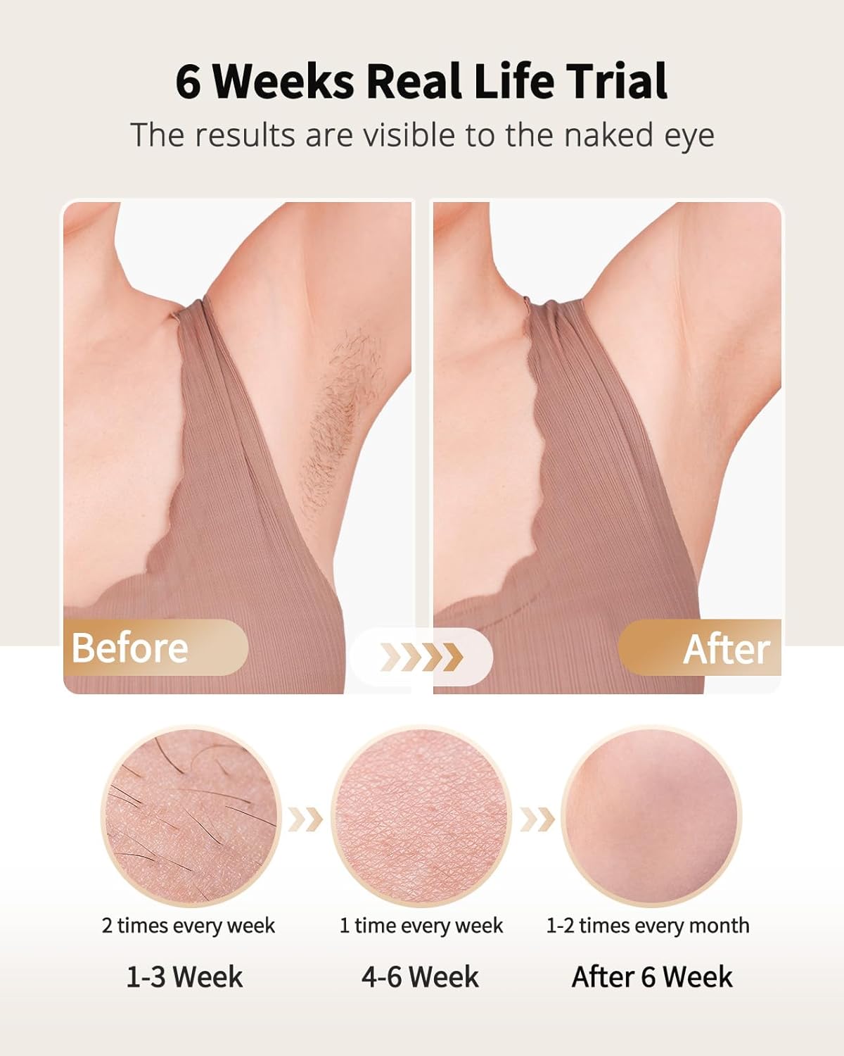 Laser Hair Removal with Ice Co - Hair Care Or Haircare incelemesi ve fiyatı