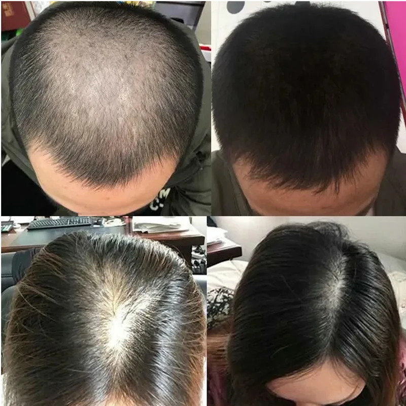 Overlord plant hair growth liq - Hair Care Or Haircare incelemesi ve fiyatı