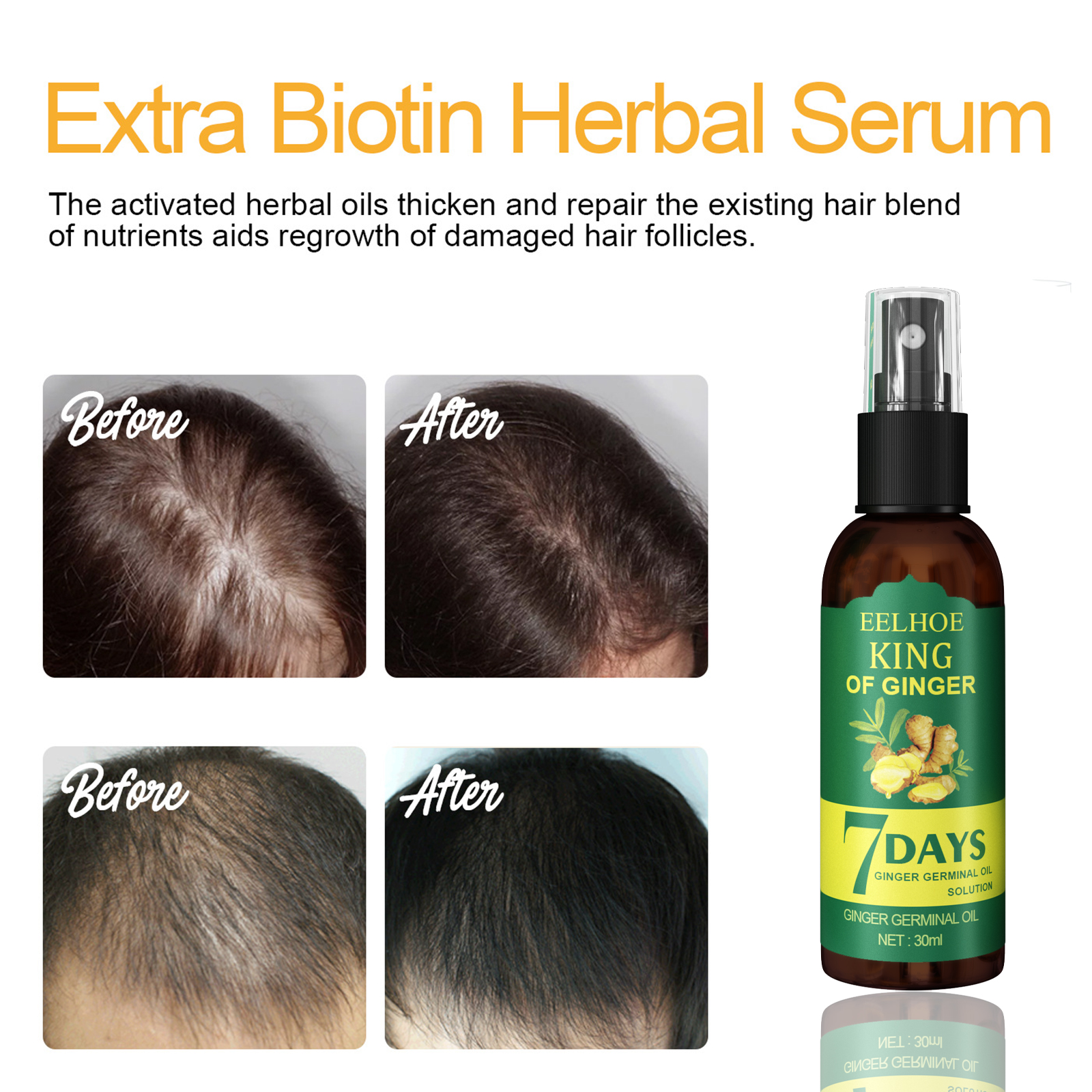 Ginger Hair Spray Root Care Se - Hair Care Daily incelemesi ve fiyatı