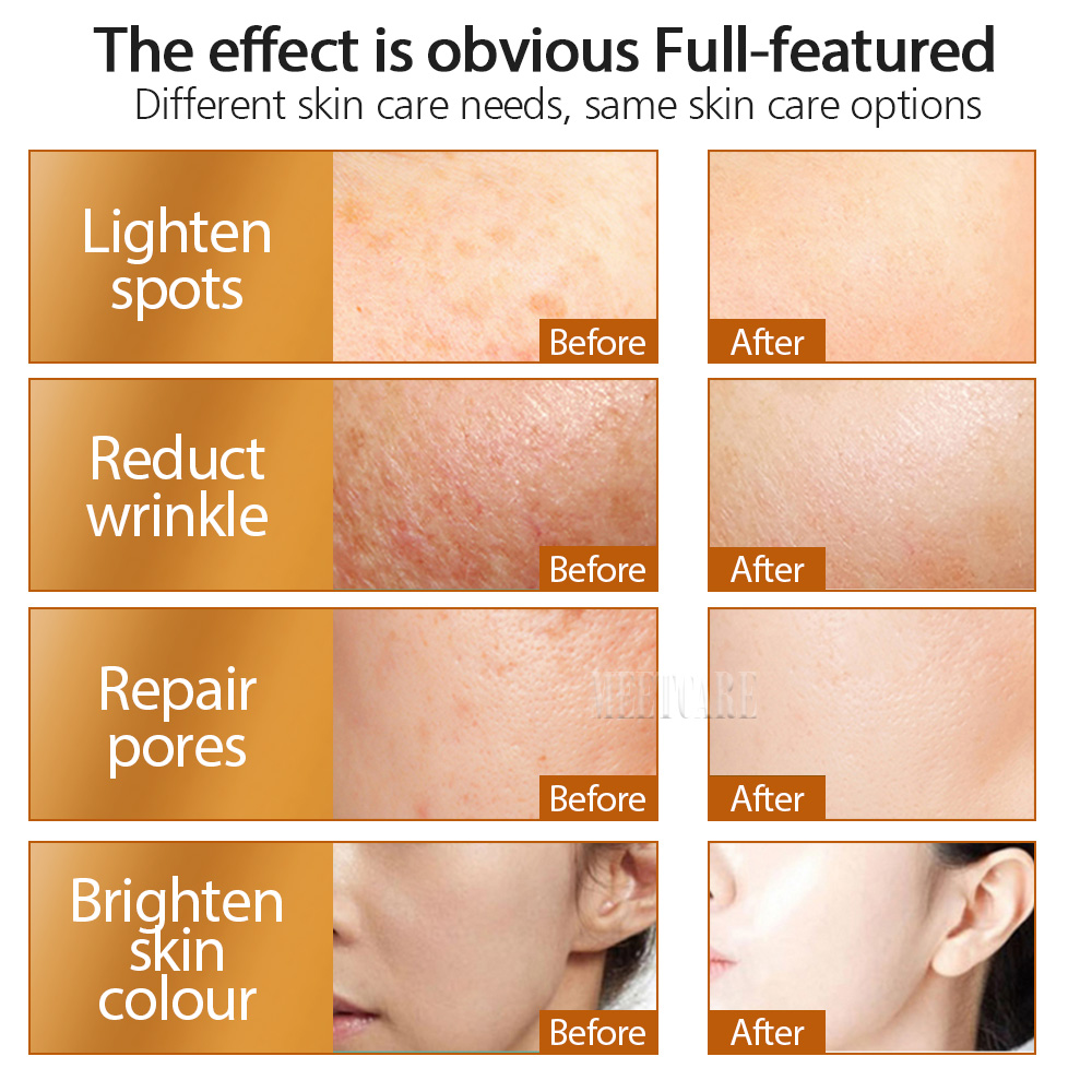 ZGTS 192pin Derma Roller Micro - Hair Care Tips incelemesi ve fiyatı