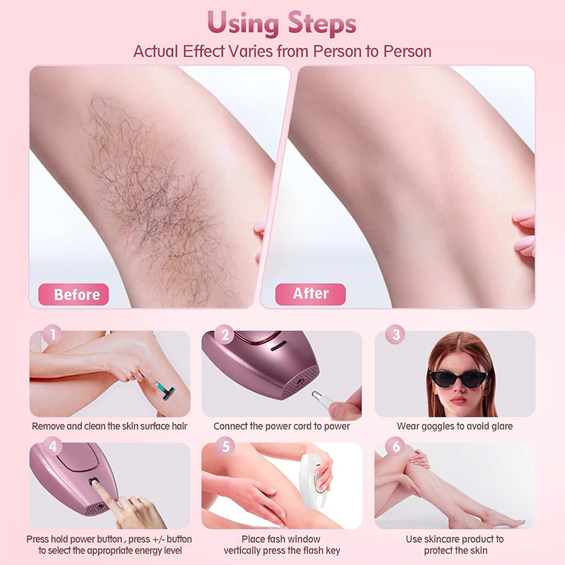 IPL laser Hair Remover Hair Cu - Hair Care Or Haircare incelemesi ve fiyatı